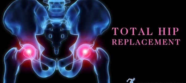 Total Hip Replacement in Delhi