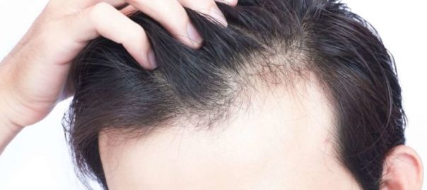 prp for hair fall