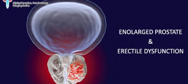 urologist in Delhi