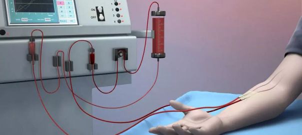 Dialysis