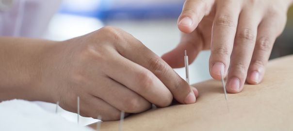 dry needling in Dwarka