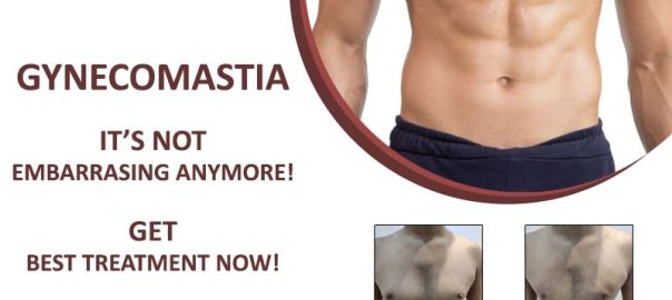 Gynecomastia Surgery