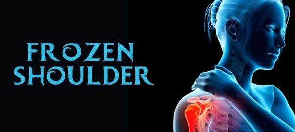 frozen shoulder