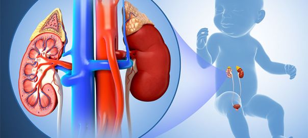 kidney dysplasia