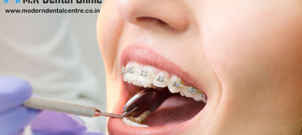 Orthodontist in Pitampura