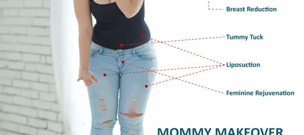 Mommy Makeover