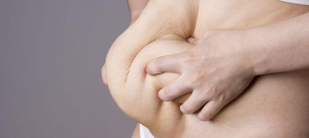 tummy tuck