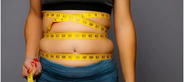post bariatric surgery body conturing