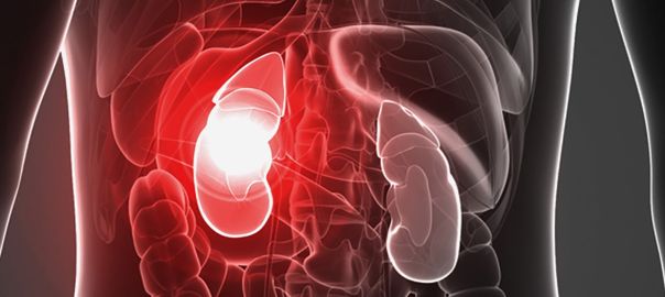 nephrologist in Delhi