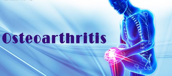 joint pain treatment in Delhi