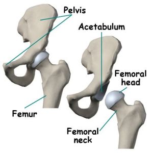 COXARTHROSIS (OSTEOARTHRITIS OF THE HIP JOINT) COXARTHROSIS (OSTEOARTHRITIS OF THE HIP JOINT)