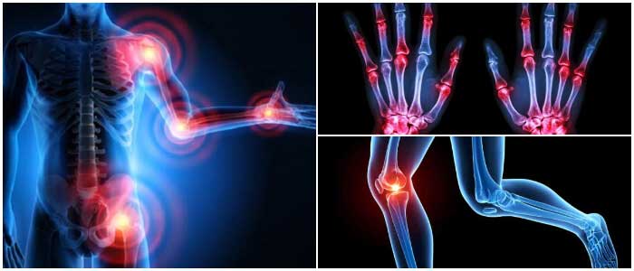Rheumatologist in Delhi Rheumatologist in Delhi