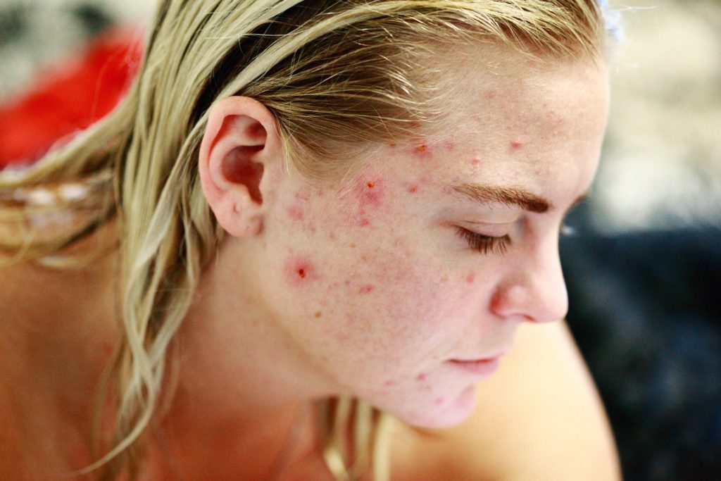 Dermatologist in Delhi Dermatologist in Delhi