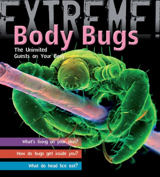 Extreme Science: Body Bugs! cover