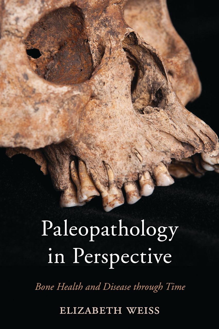 Paleopathology Examples Paleopathology in Perspective: Bone Health and Disease through Time ...