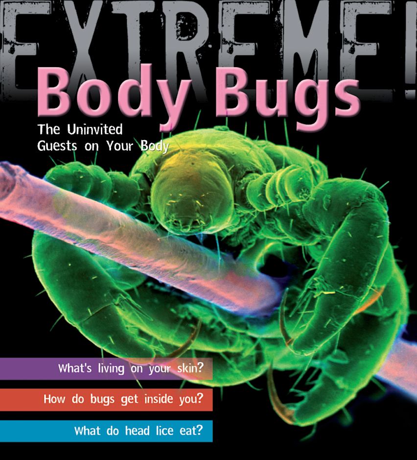 Extreme Science: Body Bugs! cover