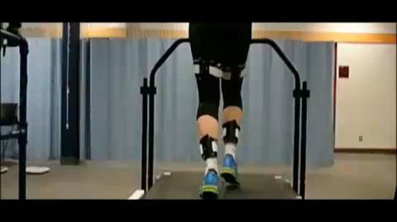 Excessive rearfoot eversion