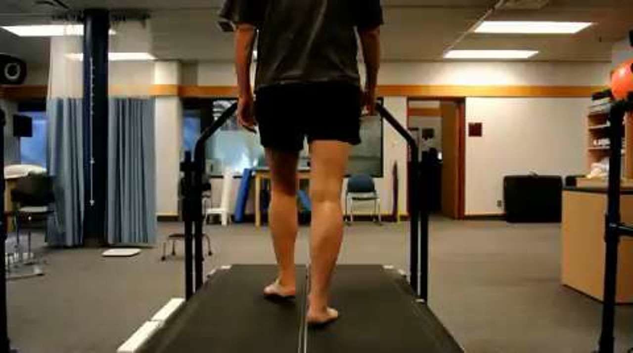 Runner with medial tibial stress syndrome walking, posterior view