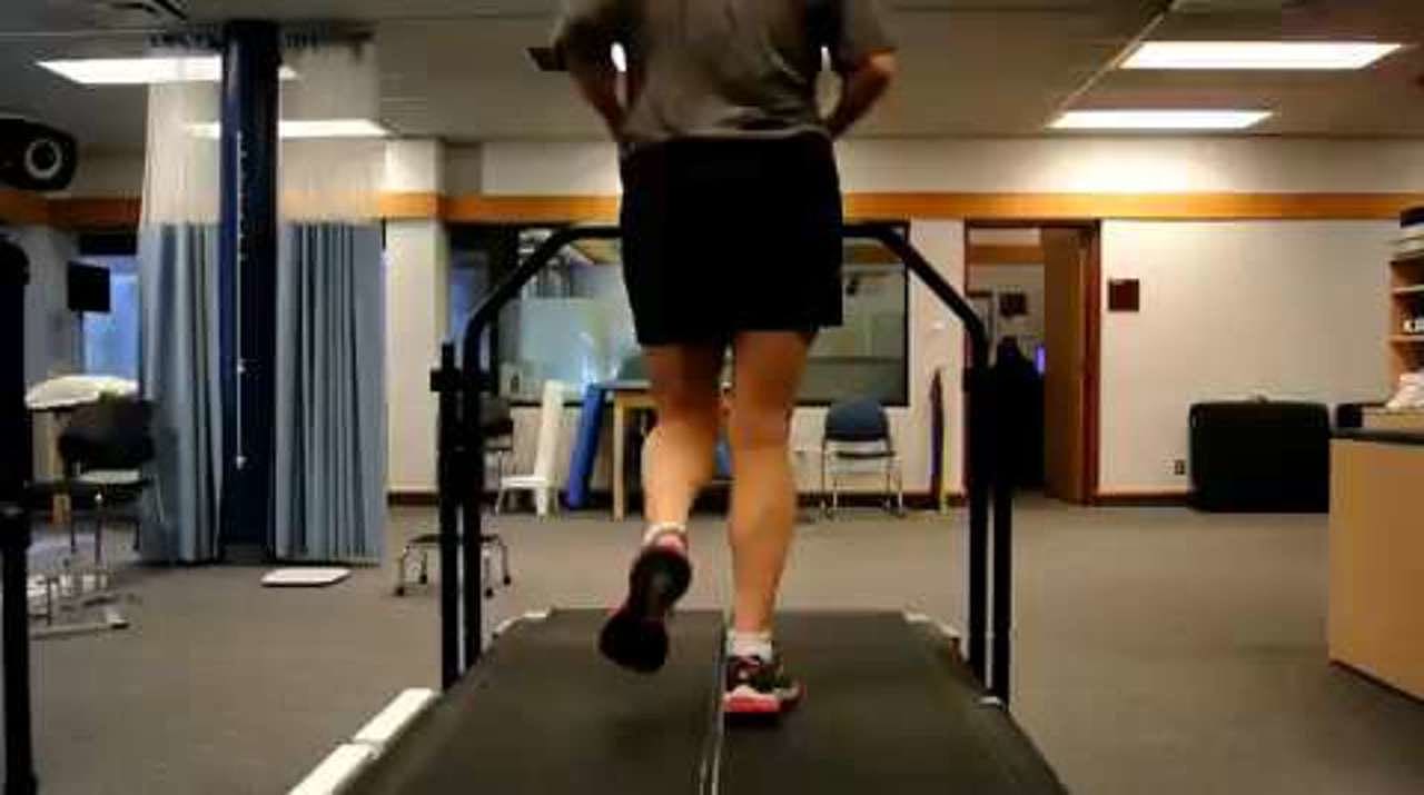 Runner with medial tibial stress syndrome running, posterior view