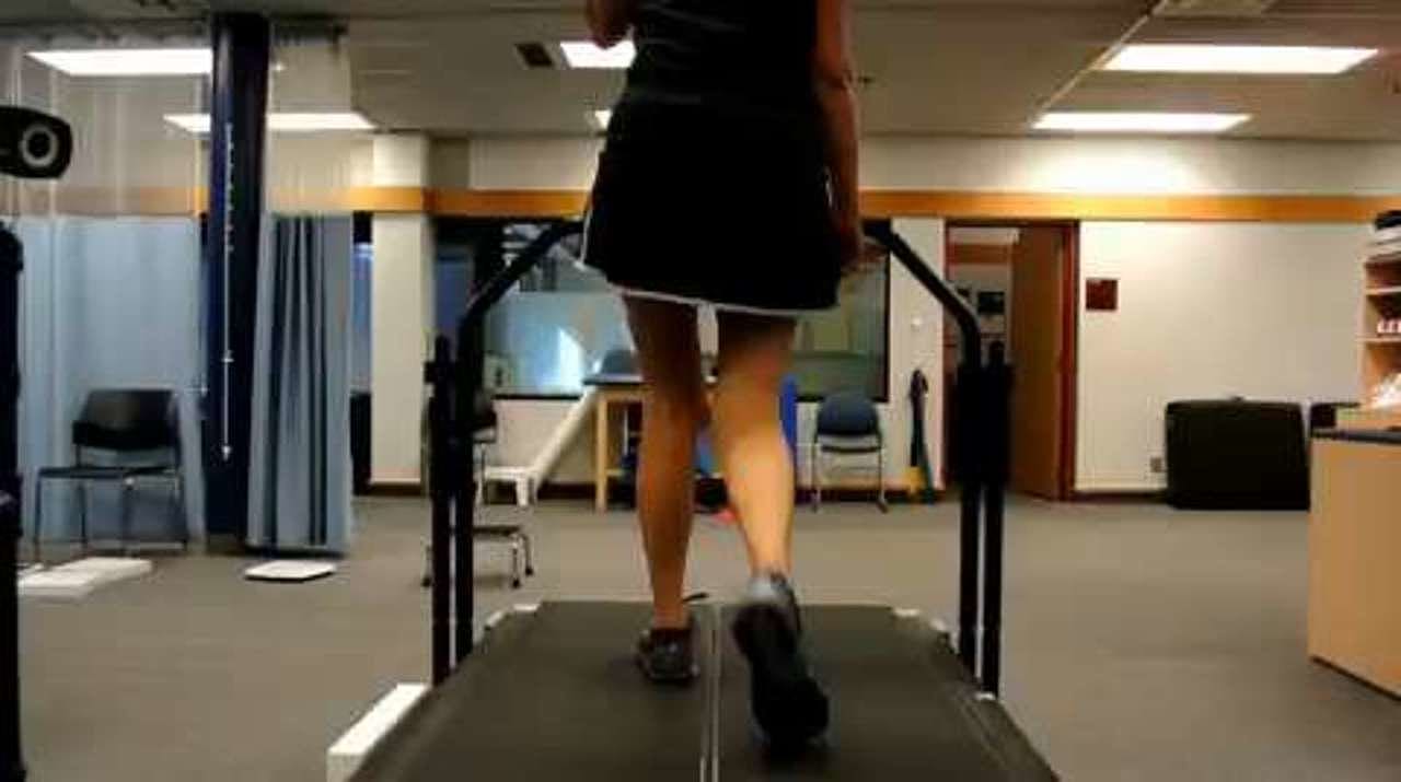Excessive knee abduction (genu valgum) during walking, posterior view