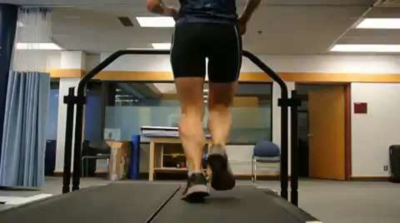 Excessive eversion velocity, posterior view