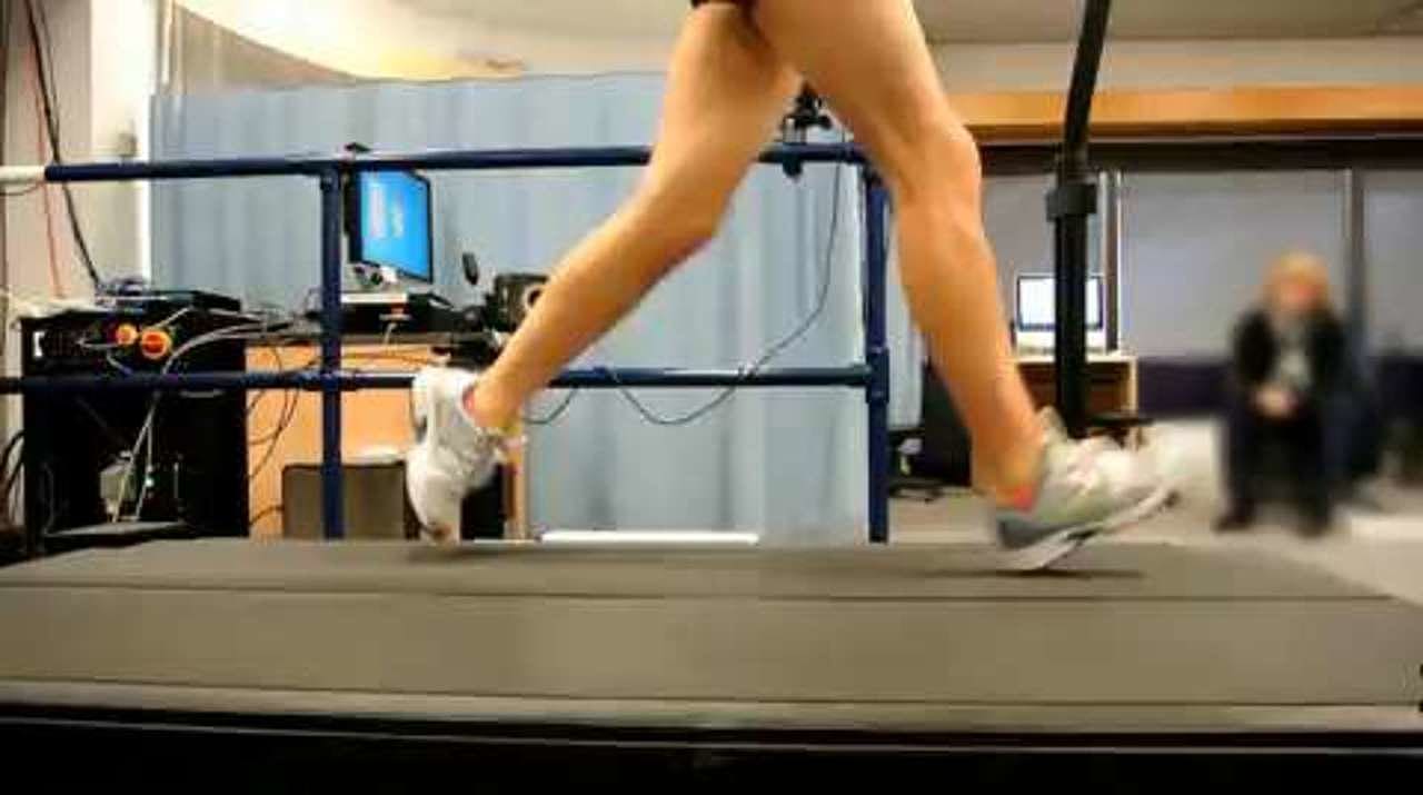 Excessive knee flexion