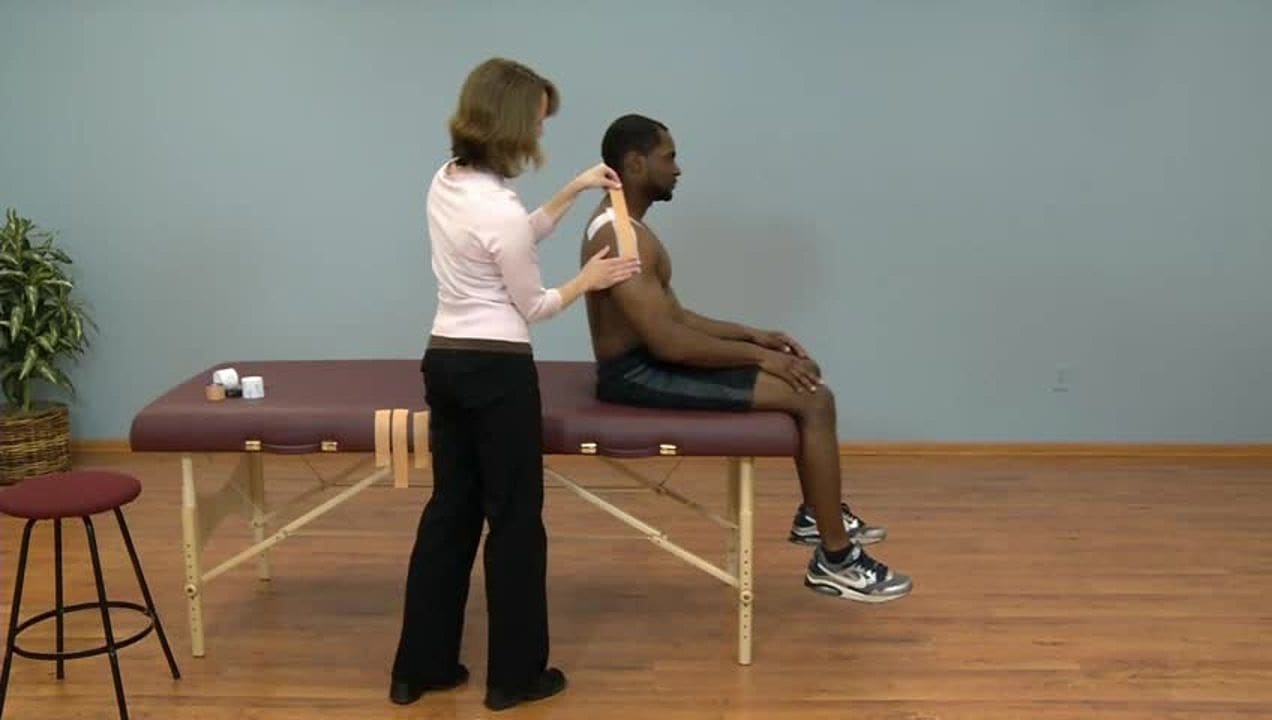 Acromioclavicular (AC) Joint Separation and Clavicle Fracture Correction