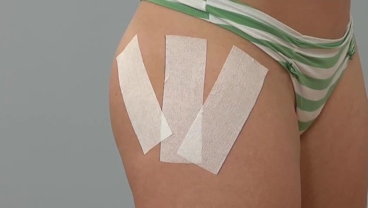 Hip and Gluteal Muscle Approximation