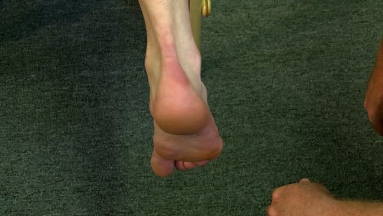 Forefoot-to-rearfoot alignment