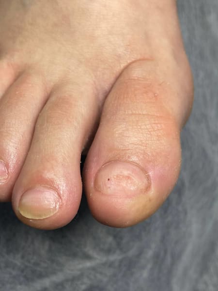 Service image for Медичний педикюр