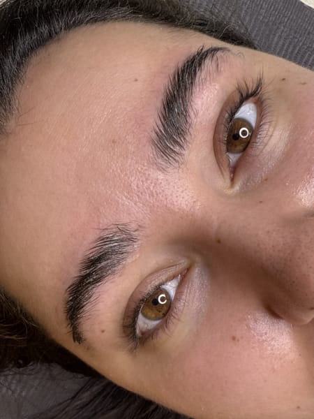 Service image for Browlift