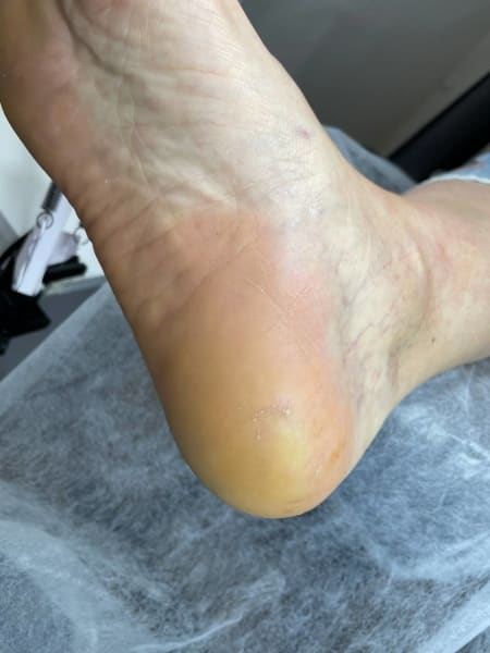 Service image for Зачистка тріщин