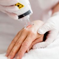 Warnzeichen Laser nach ISO 7010 (W 004) bei Lasergerät
