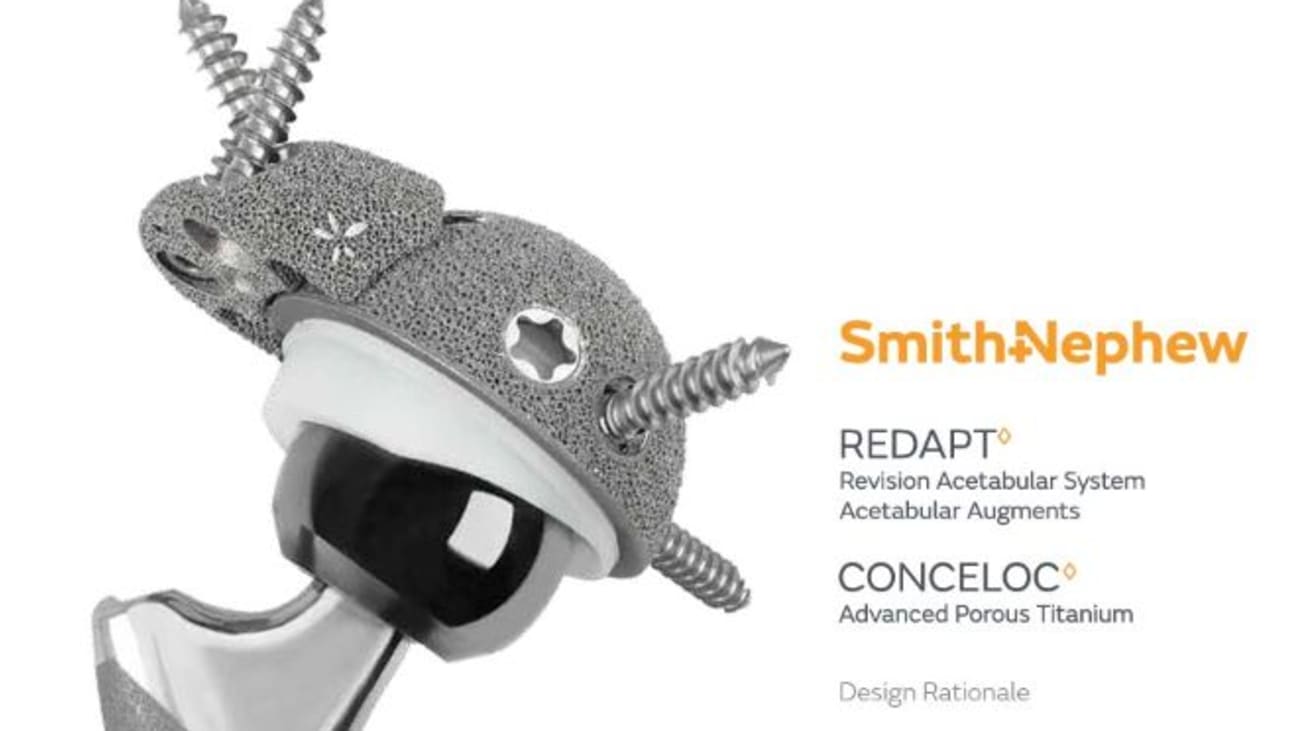 REDAPT - Smith & Nephew