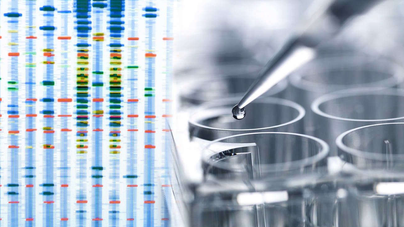 Genetic testing can help detect BRCA1 and BRCA2 mutations that increase a person’s risk for ovarian, breast and other cancers treated by experts at Cedars-Sinai. Image by Getty.