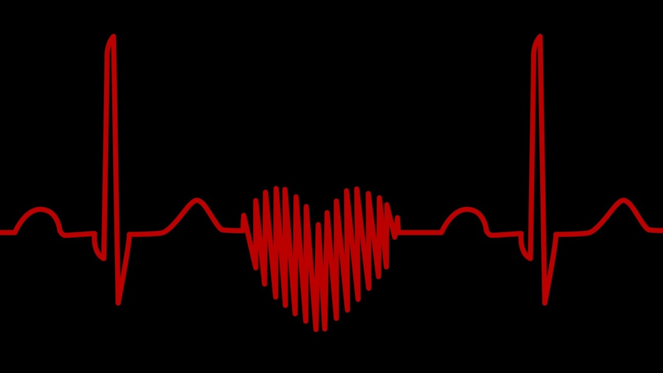 Sudden cardiac arrest is an electrical disturbance in heart rhythm that causes the heart to stop beating. Illustration by Getty.