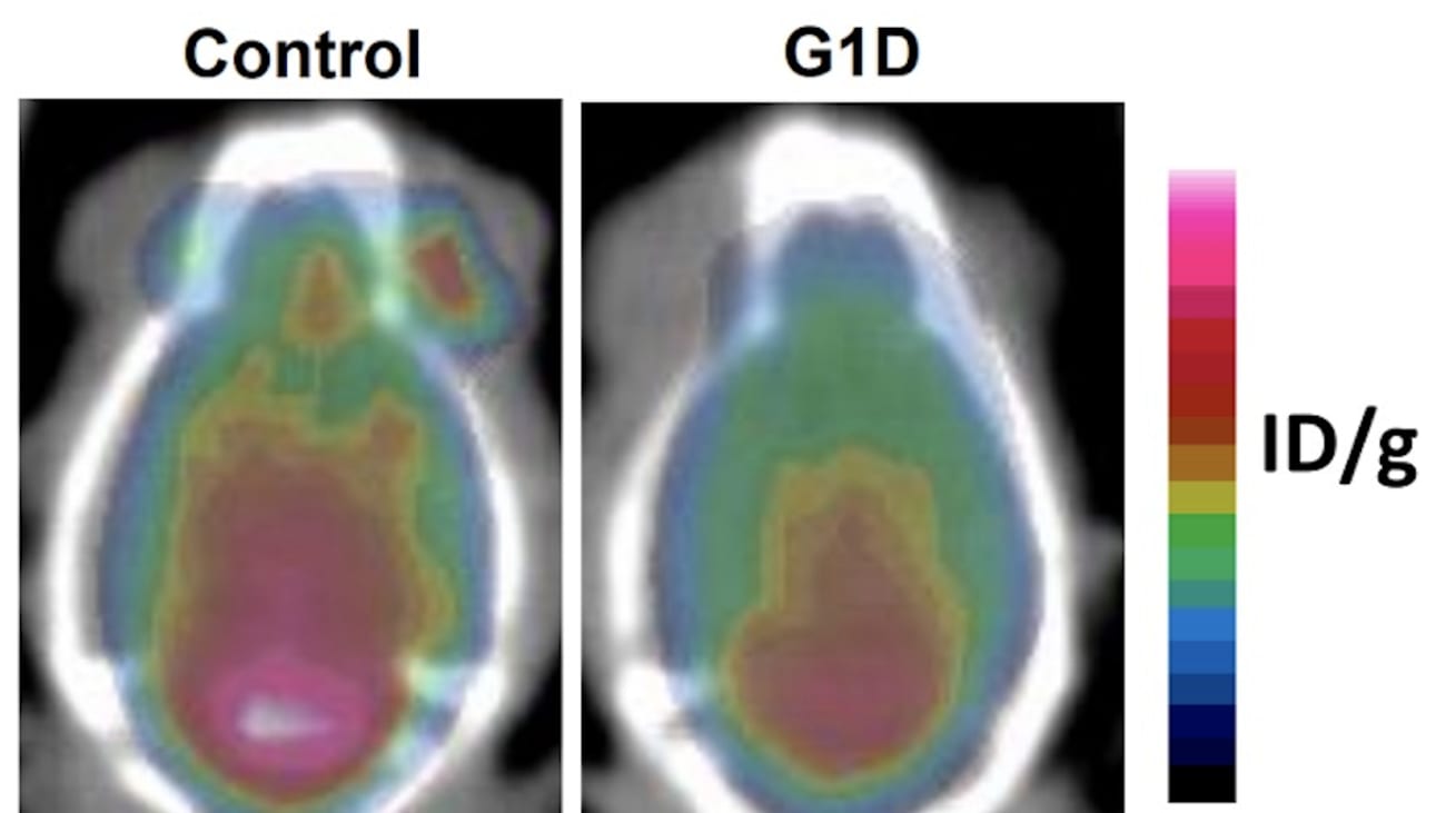 Positron emission tomography (PET) images of mouse brains in the study show decreased brain glucose with GLUT1 (G1D) deficiency relative to normal (control). The color scale at right indicates the amount of glucose present, increasing up the scale.