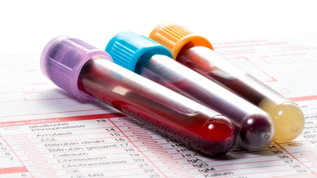 A new review article recommends fewer lab tests for hospitalized patients.