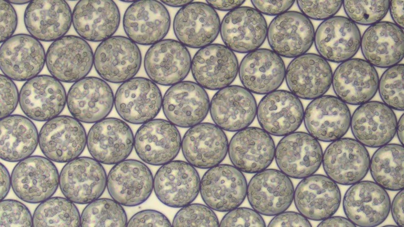 Investigators at Cedars-Sinai were recently awarded $2 million by CIRM to develop a novel injectable therapeutic to treat back pain and intervertebral disc degeneration. Pictured are microgel-encapsulated stem cells that will be used for the injectable therapeutic. Photo courtesy of the Sheyn Laboratory.