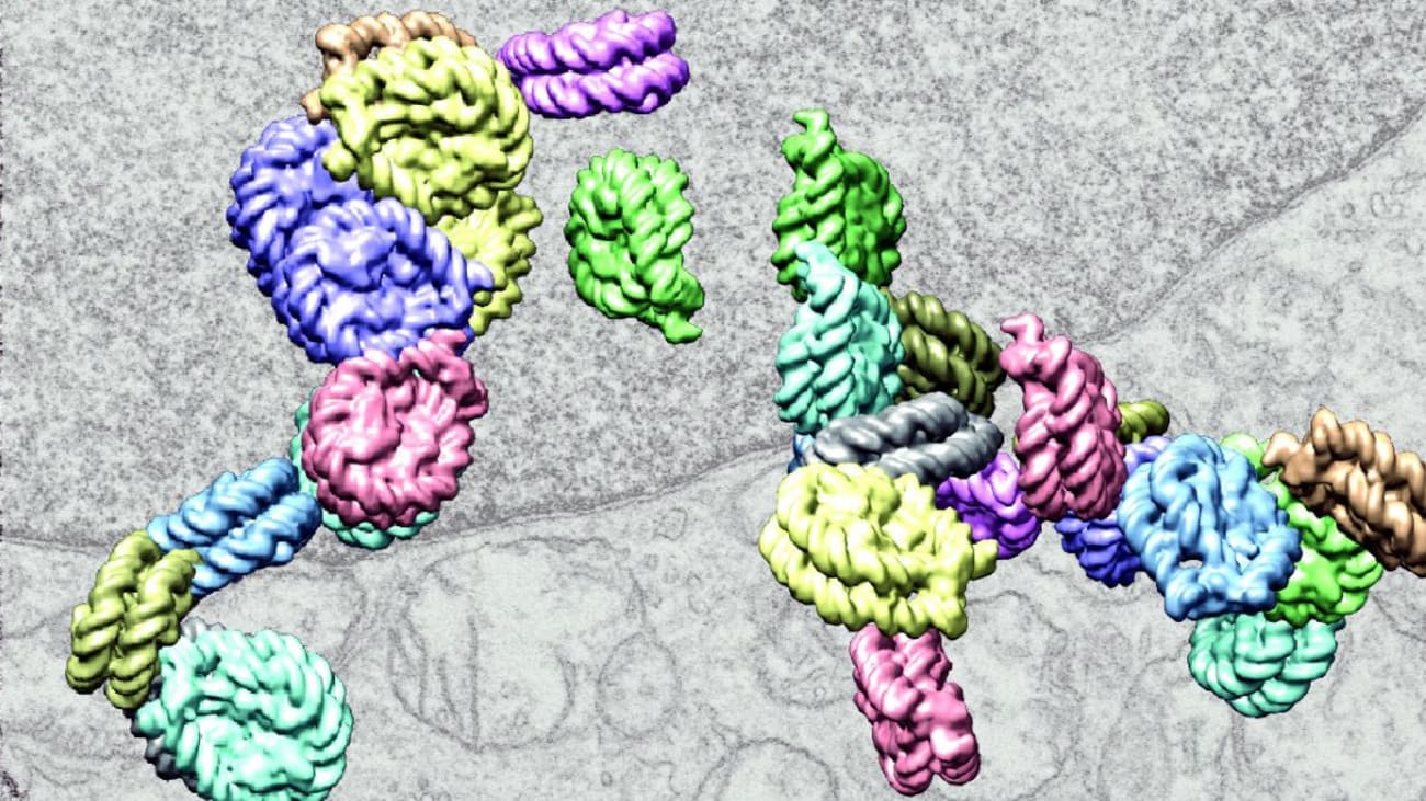 This computer-enhanced image shows interacting chains of chromatin -- the densely packaged structure of DNA. New UTSW research shows a machine-learning program can diagnose subtypes of heart disease by analyzing how molecules of DNA inside heart cells are organized into chromatin. Credit: Horng Ou, Sebastien Phan, Mark Ellisman, Clodagh O'Shea, Salk Institute, La Jolla, CA (via NIH).