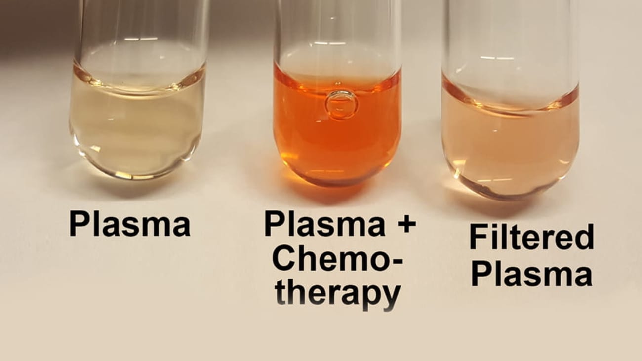 Test tubes with plasma, plasma plus chemotherapy and filtered plasma. Modified from figure in Motamarry et al article in Cancers (https://doi.org/10.3390/cancers14051322) under a Creative Commons License. Image courtesy of Dr. Haemmerich.