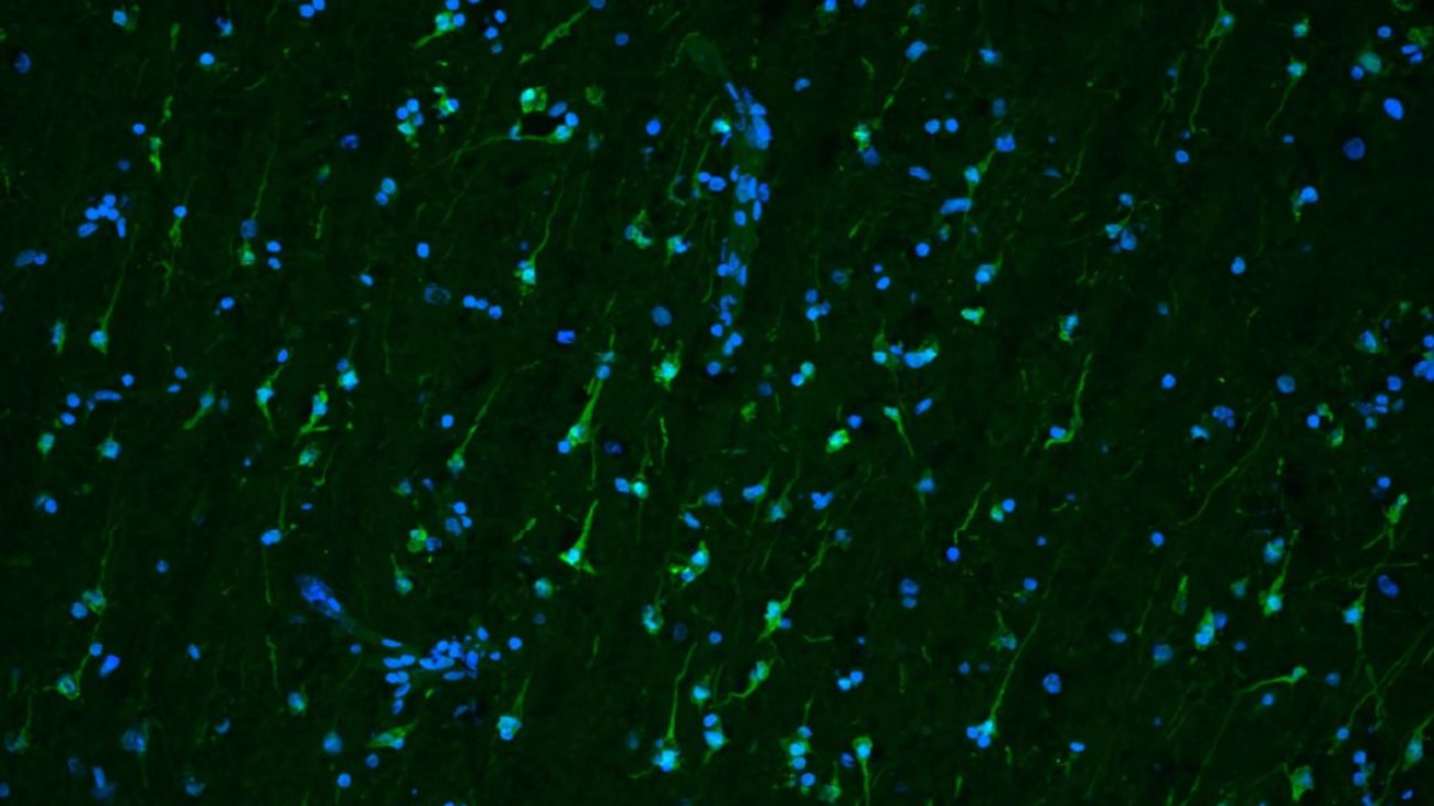 microscopic image shows brain tissue seven days after removal from a patient who had surgery for epilepsy