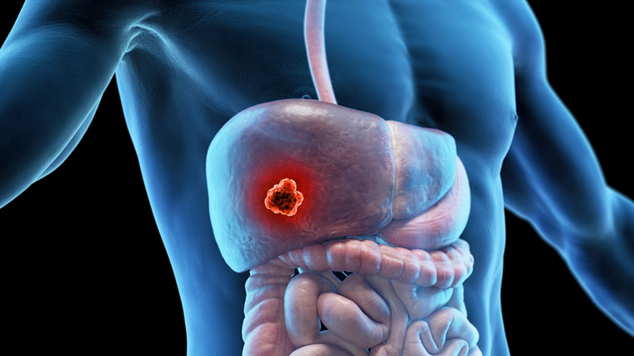Hepatobiliary Cases