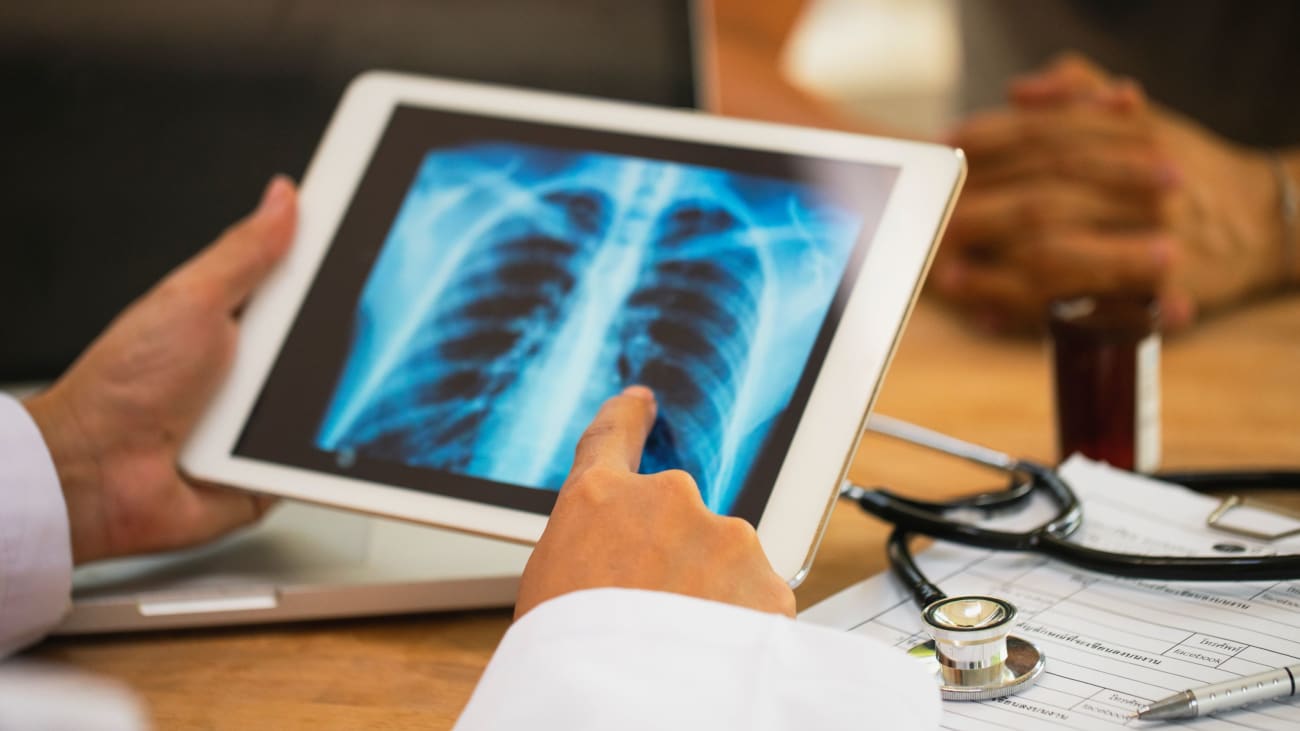 Doctors looking at thoracic image