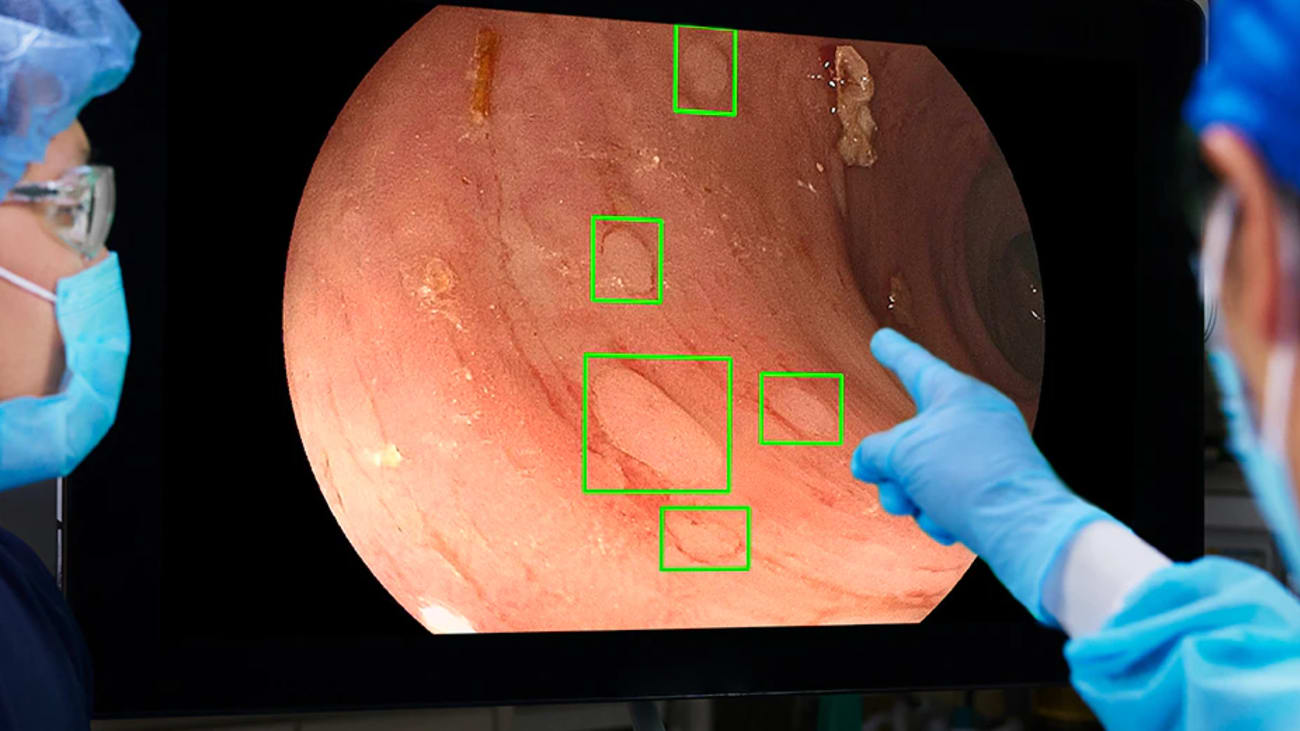 GI Genius™ monitor in use. Image © Medtronic 2023