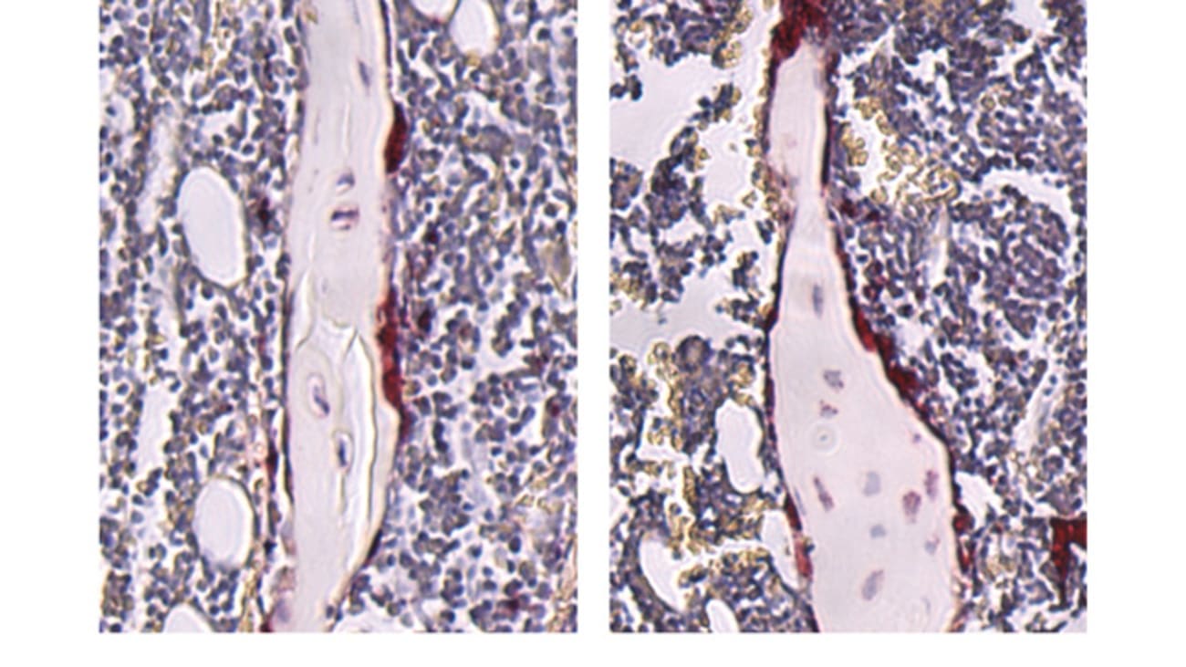 Stained tibiae from germ-free (left) and SFB-mono- associated (right) mice. Mice colonized with SFB displayed an increase in osteoclasts (stained red), which resorb bone.