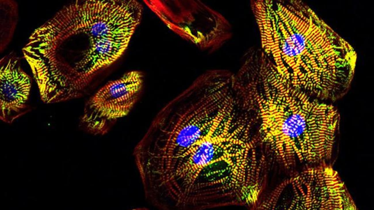 Magnification of human stem cell-derived heart muscle cells (cardiomyocytes) stained for contractile proteins (red/green/yellow) and DNA (blue).