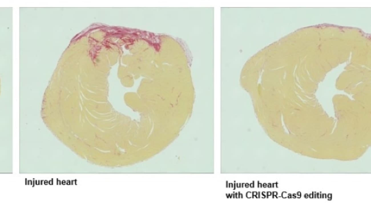 The figure shows cross-sections of mouse hearts with areas of damage in red. Treatment with virus-expressing CRISPR components reduces cardiac damage following ischemic injury.