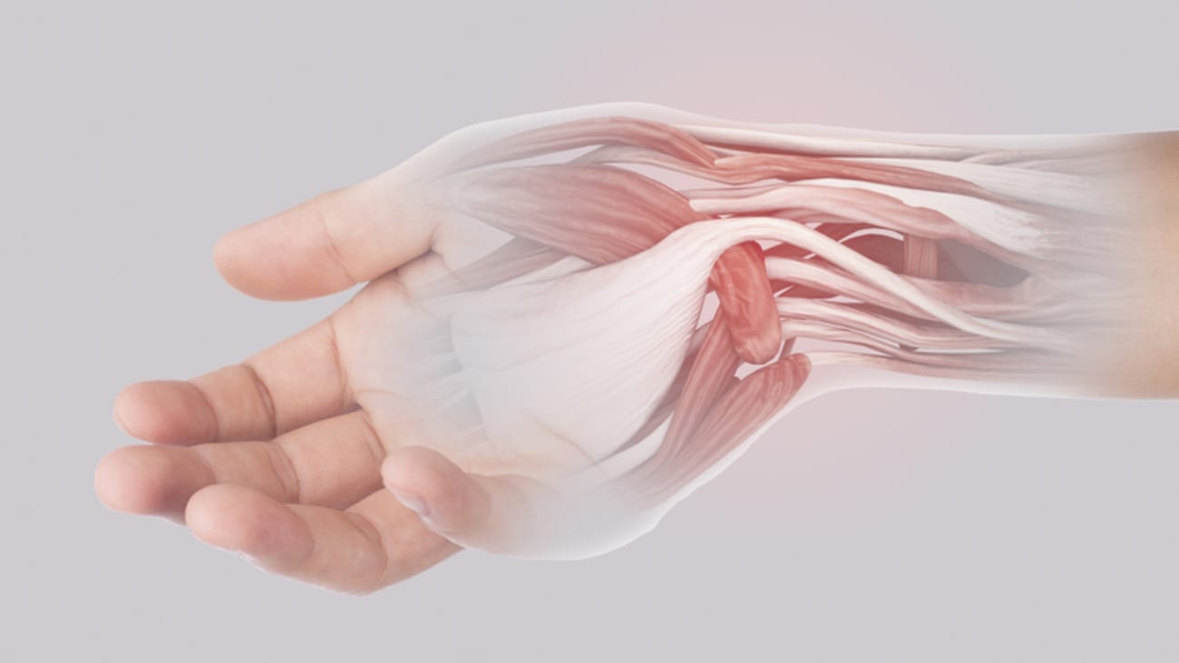 skeletal image of wrist and hand