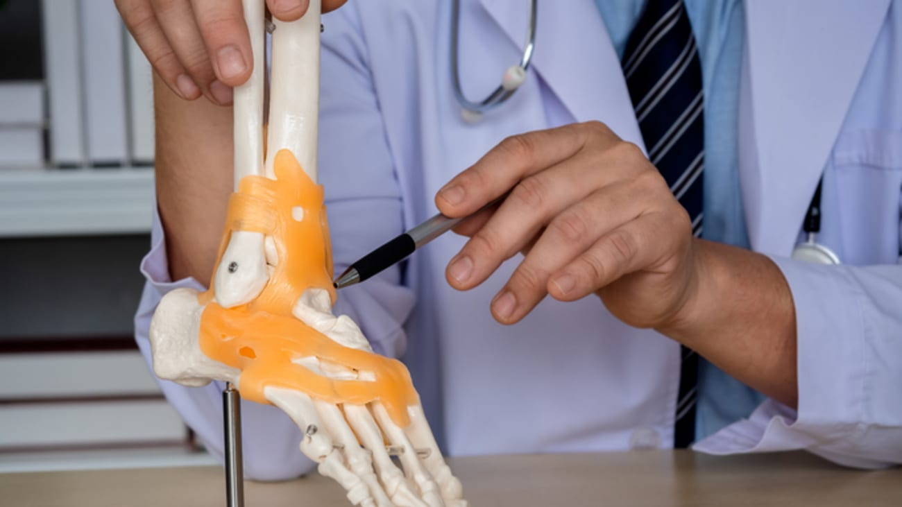 image of a skeleton foot with ankle replacement